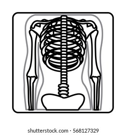 monochrome silhouette with x-ray of bones