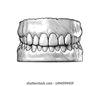 Monochrome vintage engraving drawing tooth and gum close jaw represent for dental occlusion front view illustration isolated on white background