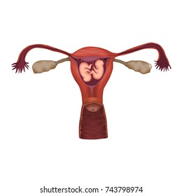 Monozygotic Twins, Embryo, Fetus In Uterus, Placenta, Umbilical Cord. Vector Medical Illustration. Colored Image, White Background.