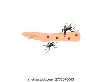 Picada de mosquito na pele da mão