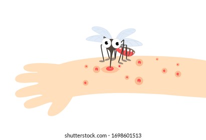 Mosquito Bite Hand Vector