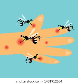 mosquito bite hand. vector illustration.