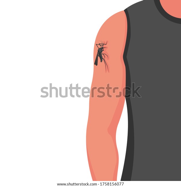 Mosquito bite on skin hand human. Insect\
bites man in arm. Template dangers Zika virus. Drinks the blood.\
Bloodsucking pest. Vector illustration flat design. Isolated on\
background. Malaria\
epidemic.\
