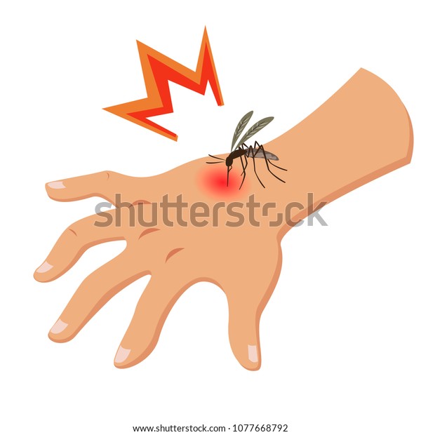 the mosquito\
bites the hand vector\
illustration