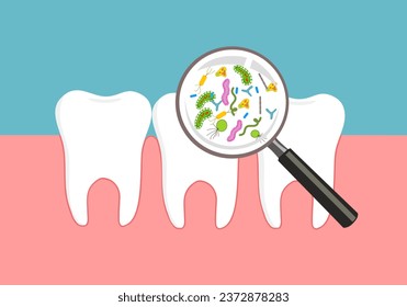 The most common bacteria associated with dental cavities are the mutans streptococci, most prominently Streptococcus mutans and Streptococcus sobrinus.