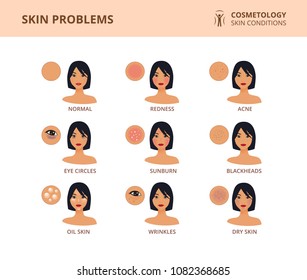 Most Common Female Facial Skin Problems Stock Vector (Royalty Free ...