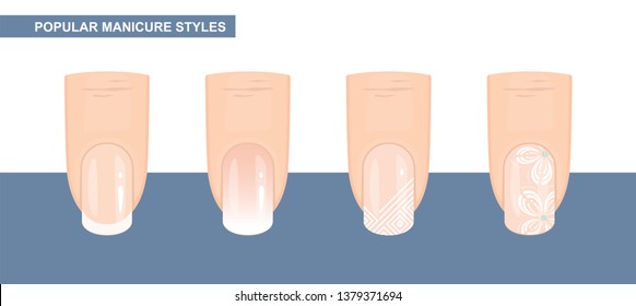 Most Popular Nail Designs. Manicure styles. Vector Illustration