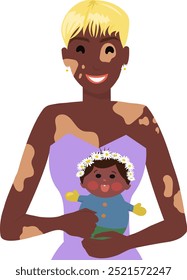 Mother with a newborn baby. Happy mom with vitiligo flat vector illustration