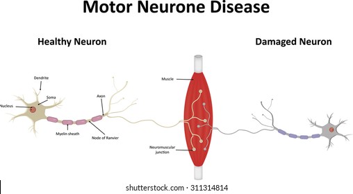 Motor Neuron High Res Stock Images Shutterstock