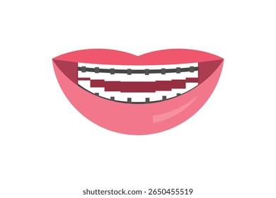 Mouth with braces showing orthodontic alignment. Ideal for dental education visuals and patient instructions.