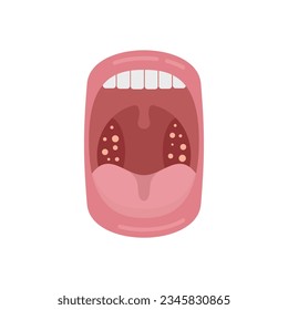 Mouth disease icon flat vector. Bacterial anatomy. Ent inflammation isolated