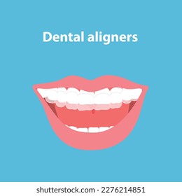 Mouth guard. Teeth with transparent braces. Alignment of teeth by aligners. Orthodontic dentistry concept. Dental care. Vector illustration isolated on blue background.