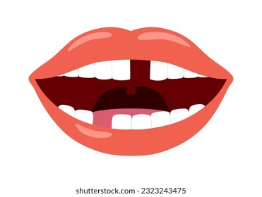 Mouth with missing teeth in flat design on white background. Dental problem.