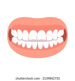 mouth open deep bad bite teeth gum Joint pain jaw surgery corrective bone oral smile Lower Weak Chin health extra Spacing Anterior fixed