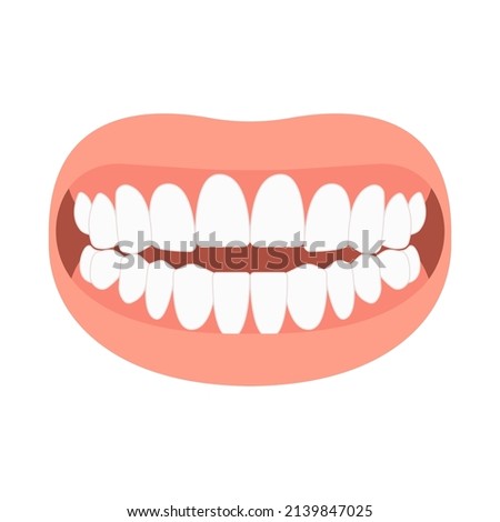 mouth open deep bad bite teeth gum Joint pain jaw surgery corrective bone oral smile Lower Weak Chin health extra Spacing Anterior fixed