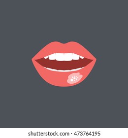 Mouth Sores Icon In Flat Style