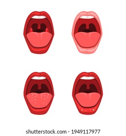 Mouth and throat sore disease icon set. health dental clinic symbol concept in cartoon illustration vector