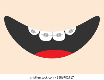 Mouth with tongue and tooth braces. Smiling face. Healthy teeth brace. Body part. Cute cartoon character. Oral dental hygiene Children teeth care icon. Baby background. Flat design Vector illustration