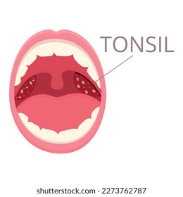 Vector de dibujos animados de iconos de la tonsilitis bucal. Higiene bacteriana. Medicamento contra el cáncer