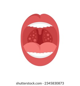 Mouth tonsillitis icon flat vector. Tonsil anatomy. Bacterial ent isolated