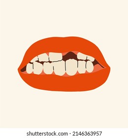 Mouth without one tooth. Flat design, hand drawn cartoon, vector illustration.