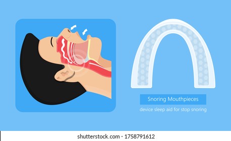 Mouthpiece a device for stop snoring