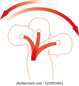 Movement of the neck due to impact from the back. Whiplash injury.