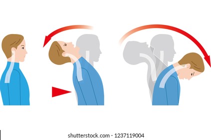 Bewegung des Nackens durch Aufprall von hinten. Whiplash Verletzung.