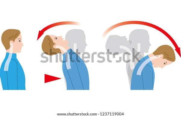 Movement Neck Due Impact Behind Whiplash Stock Vector (Royalty Free ...