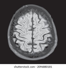 mri of the brain of an adult male on a black background