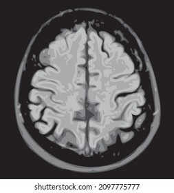 mri del cerebro de un macho adulto sobre un fondo negro