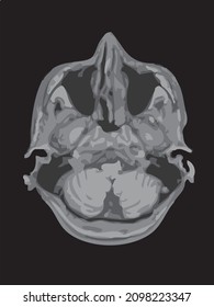 mri of the brain of an adult male on a black background