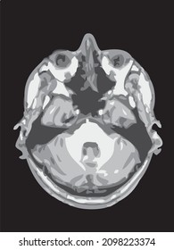 mri of the brain of an adult male on a black background