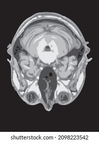 mri of the brain of an adult male on a black background