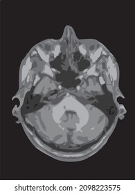 mri of the brain of an adult male on a black background