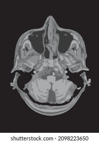 mri of the brain of an adult male on a black background