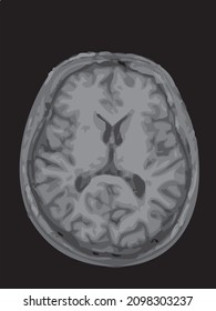 mri of the brain of an adult male on a black background