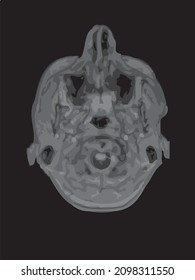 mri of the brain of an adult male on a black background