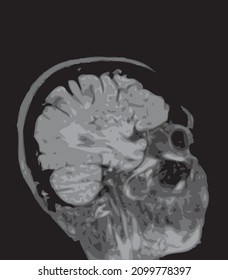 mri of the brain of an adult male on a black background