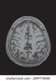 mri of the brain of an adult male on a black background