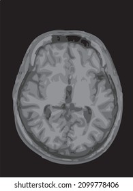 mri of the brain of an adult male on a black background