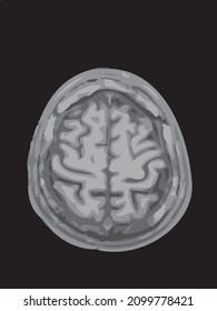 mri of the brain of an adult male on a black background