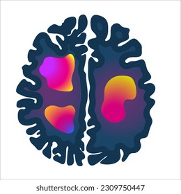 MRI brain scan icon. Medical imaging technology for mental health assessment and abnormality diagnostics. Activity visualization. Vector illustration isolated on white.
