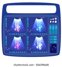 MRI Image Of Hand. Medical Thermal And Other Medical Scanners Concept. The Portable Medical Device.