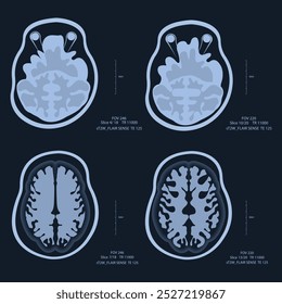 IRM - Imágenes por resonancia magnética - Ilustración. Imágenes de rayos X del cerebro