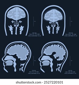 IRM - Imágenes por resonancia magnética - Ilustración. Imágenes de rayos X del cerebro