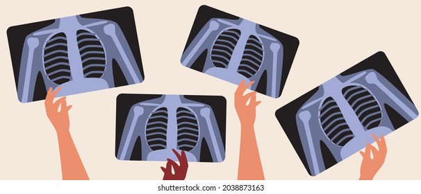 MRI scans of the lungs. Flat vector stock illustration. Concept of computer tomogram or MRI. Medical examination or fluorography. Hand and x-ray. Isolated illustration