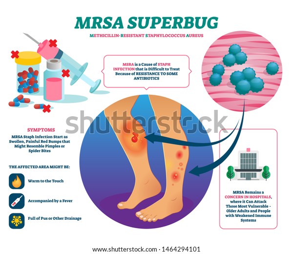 sintomas de mrsa sintomas de mrsa