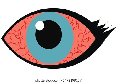 Mucous membrane pemphigoid,Cicatricial,chronic autoimmune causing blistering and scarring of the mucous membranes, including the eyes,Stevens-Johnson syndrom,ocular,Mooren's ulcer