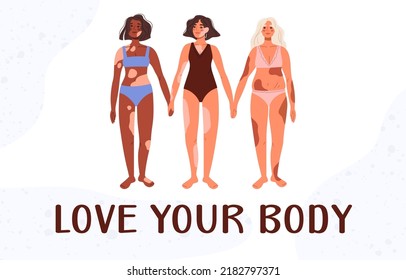 Mujeres multinacionales con problemas de piel en traje de baño. Amor propio. Enfermedad cutánea. Enfermedad de pigmentación corporal positiva. Inscripción Ama tu cuerpo Ilustración vectorial plana